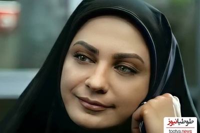 تغییر چهره 360 درجه لعیا زنگنه بازیگر سریال در پناه تو به لطف بوتاکس و عمل زیبایی +عکس