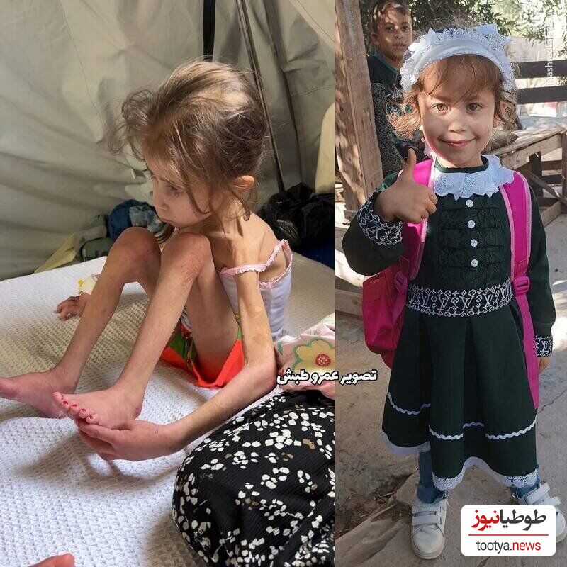  دختر بچه فلسطینی قبل و بعد حمله اشغالگران به غزه
