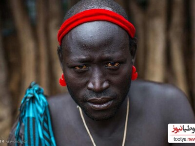 (تصویر)پسر آفریقایی با عجیب الخلقه ترین بدن همه را وحشت زده کرد!/مردی که دست و پاش جابجا رشد کردن