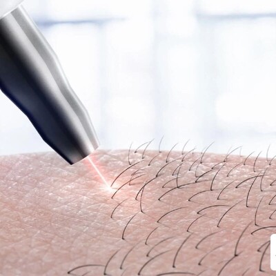 شایع ترین عوارض لیزر موهای زائد بدن + روش جلوگیری از آن ها