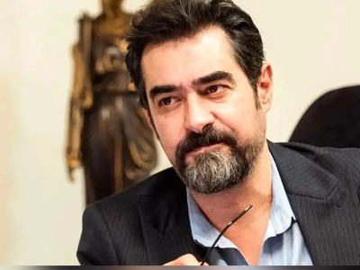 ویدیویی خنده دار از شهاب حسینی که ادای خانمهایی که تزریق ژل انجام داده‌اند رو درمیاره😂