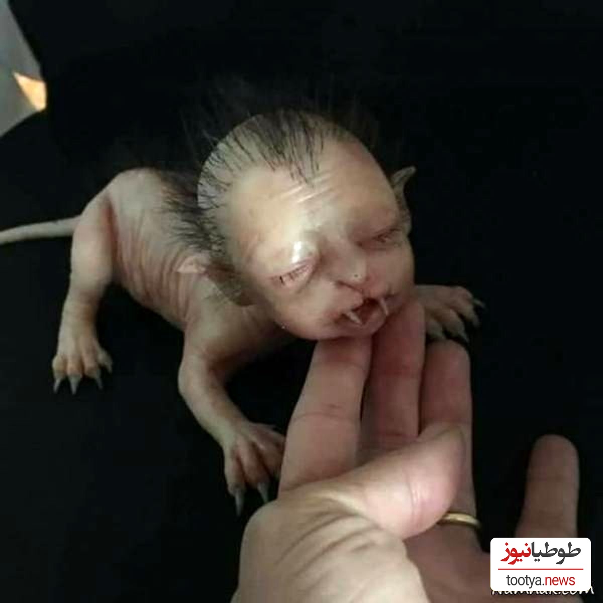 تولد نوزاد 4 پای عجیب الخلقه نیمه انسان و نیمه حیوان! از حکمت خدا نمیشه ساده رد شد!