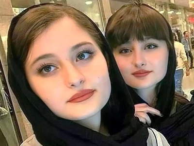 از دخترکان معصوم «پایتخت» تا چهره‌های امروزی؛ جراحی‌های زیبایی با سارا و نیکا چه کرده است؟