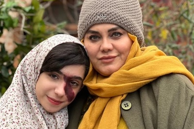 تغییر باورنکردنی چهره اسرا جلیلیان، کنیز ترلان پروانه در «بامداد خمار»؛ از زنگ طلایی «عصر جدید» تا قاب دوربین نرگس آبیار