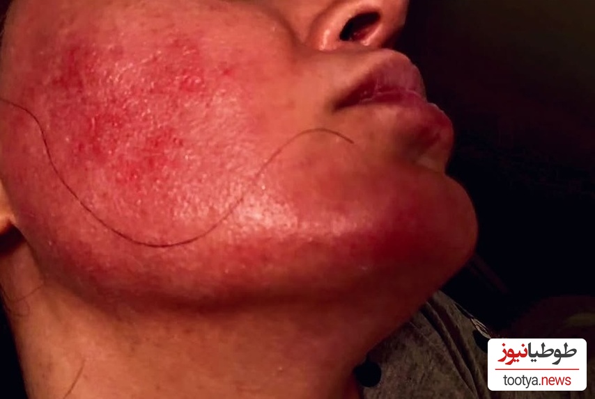 الناز شاکردوست