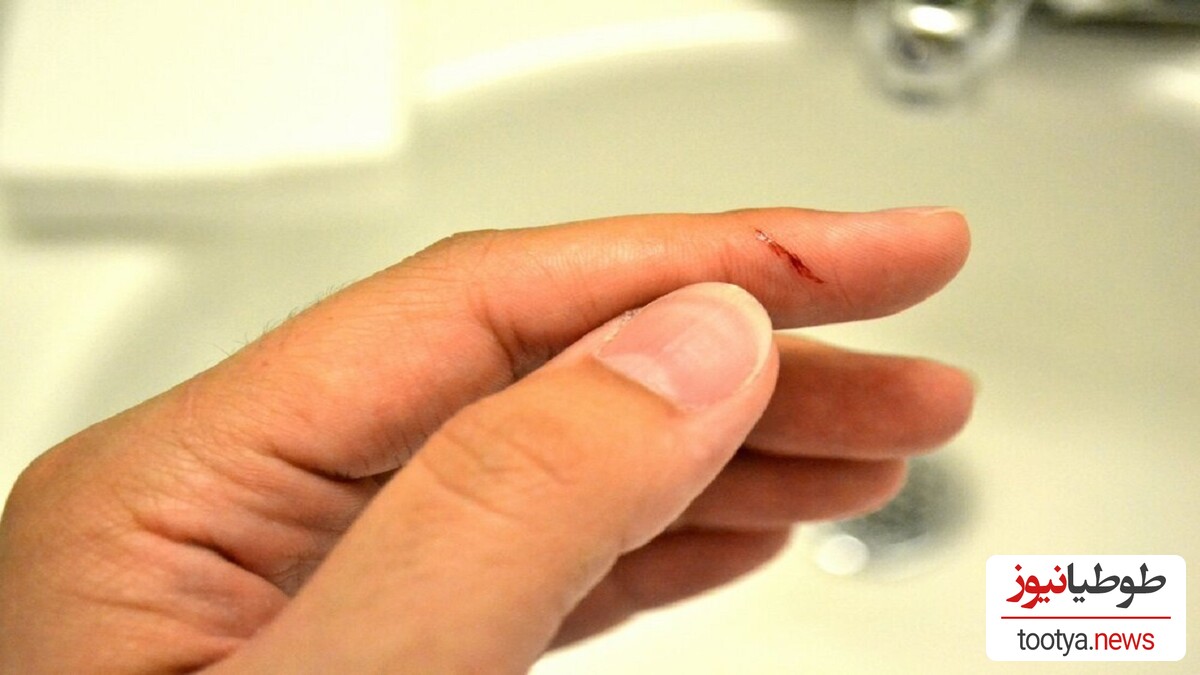 (ویدئو) به هیچ عنوان زخم‌ های کوچک روی دست را دست‌ کم نگیرید / زخم کوچکی که منجر به قطع دست و پاهای این مرد شد