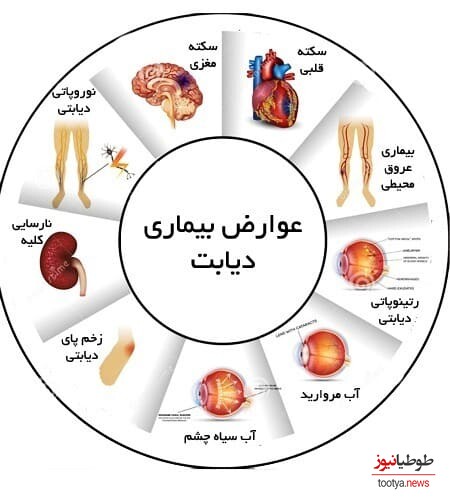 دیابت