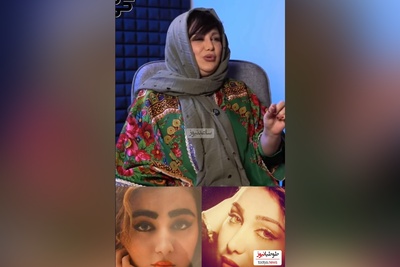 ویدئو/بهنوش بختیاری: وقتی 18 سالم بود بینیم رو عمل کردم و یه دختر شجاع بختیاری از هیچی نمیترسه!