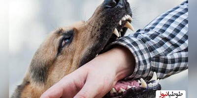 (+18)تصاویر دلخراش و تلخ از حمله سگ‌های ولگرد ‌به دختر 5 ساله!/دیگه صورتش کلا نابود شده