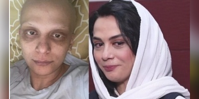 شوک مارال فرجاد از بی‌رحمیِ آدم‌ها؛ حکایت تلخ کلاه‌گیس و تهمتِ ترحم در روزهای شیمی‌درمانی +ویدیو