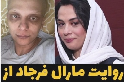 شوک مارال فرجاد از بی‌رحمیِ آدم‌ها؛ حکایت تلخ کلاه‌گیس و تهمتِ ترحم در روزهای شیمی‌درمانی +ویدیو