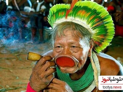 بهای سنگین زیبایی؛ زنانی که برای جذابیت لب‌های خود را می‌برند!/ وحشتناک یا زیبا؟