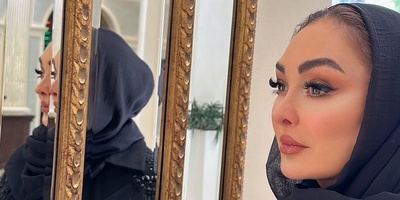 الهام حمیدی: تا حالا بوتاکس نکردم/ مخالف عمل زیبایی نیستم اما احساس میکنم...+ویدیو