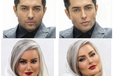 اگر بازیگران محبوب ما در سال 2026 جراحی زیبایی می‌کردند، چه شکلی بودند؟+ویدیو