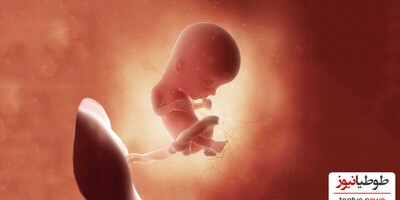 (تصاویر) زنی که مدعی است خاطرات دوران جنینی در شکم مادرش را به یاد دارد/ اختلالی که باعث میشه ذهن هیچ خاطره ای رو رها نکنه
