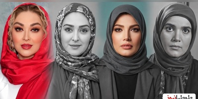 این تصاویر قدیمی همه را متعجب کرد؛ بازیگران زن قبل از معروفیت و بعد از عمل‌های زیبایی +ویدیو