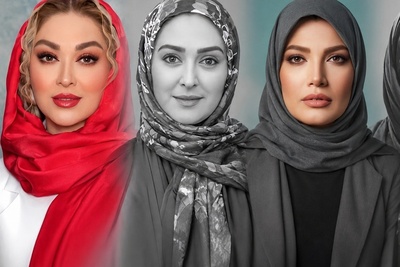 این تصاویر قدیمی همه را متعجب کرد؛ بازیگران زن قبل از معروفیت و بعد از عمل‌های زیبایی +ویدیو