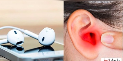 (ویدئو) اگر از ایرپاد استفاده میکنید دیدن این ویدئو برای شما ضروری است!/ اثرات مخرب ایر پاد بر روی گوش شما که خودتان نمیدانستید!