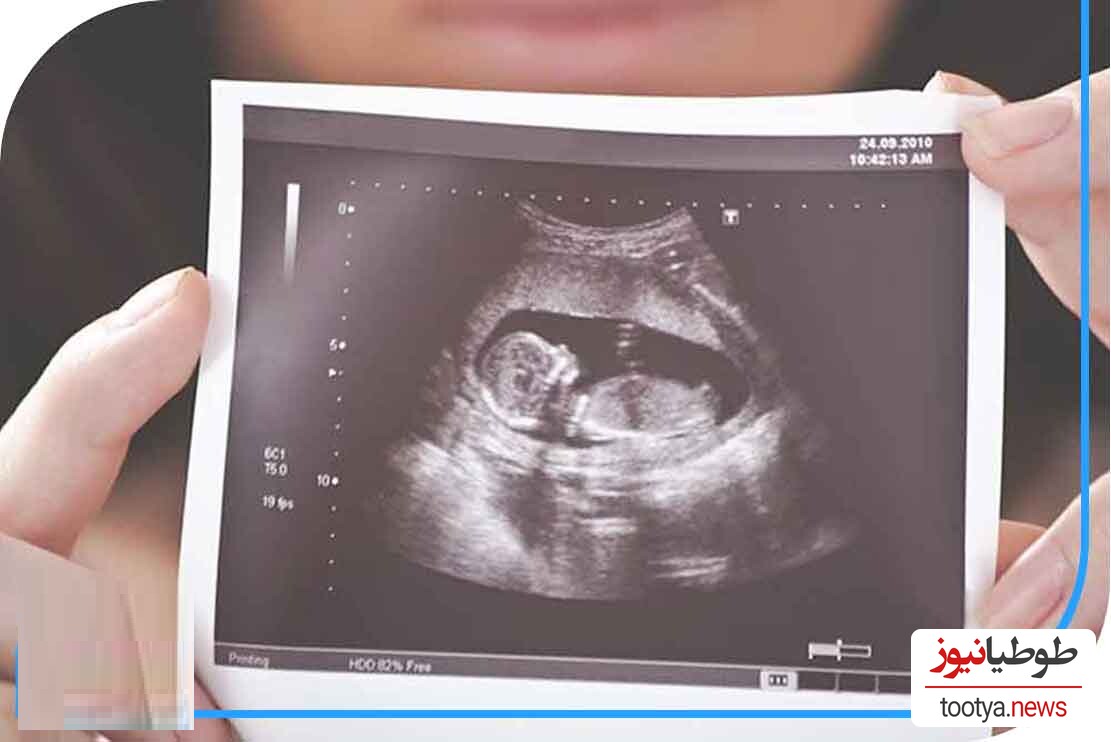 ویدیو واقعی و باور نکردنی از زندگی جنین در ماه های آخر بارداری در بدن مادر/ میبینین حتی تو اون فضای محدودم دنبال بازی و شیطنته