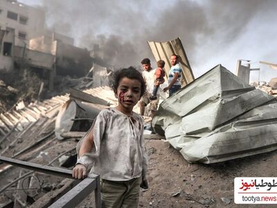 عکس باورنکردنی و دردناک از دختر بچه فلسطینی قبل و بعد حمله اشغالگران به غزه