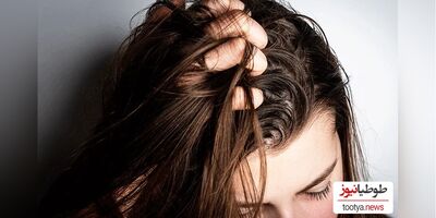 10 روش برای رفع و کاهش چربی موها