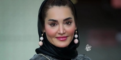 3 آیتم مهم تابستان در استایل سولماز حسینی مناسب خانم های جوان