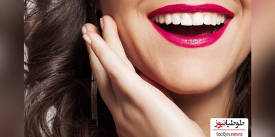 برای سفید دیده شدن دندان ها رژلب چه رنگی بزنیم؟💄