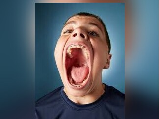 (عکس) رکورد عجیبترین و گشادترین دهان دنیا رو این فرد شکست/میتونه دهنش رو تا 10 سانتی متر باز کنه!