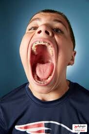 (عکس) رکورد عجیبترین و گشادترین دهان دنیا رو این فرد شکست/میتونه دهنش رو تا 10 سانتی متر باز کنه!