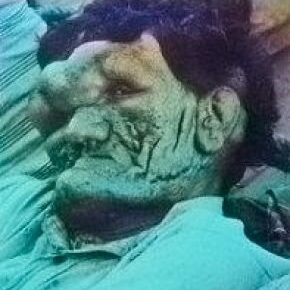 راز مرد 259 سانتی‌متری ایران؛ غولی که در تنهایی و غربت جان داد/ ماجرای عجیب غول نیشابور!