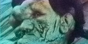 راز مرد 259 سانتی‌متری ایران؛ غولی که در تنهایی و غربت جان داد/ ماجرای عجیب غول نیشابور!