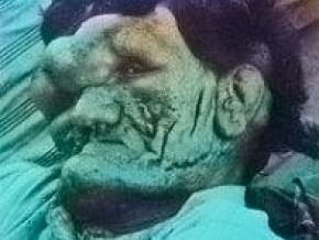 راز مرد 259 سانتی‌متری ایران؛ غولی که در تنهایی و غربت جان داد/ ماجرای عجیب غول نیشابور!