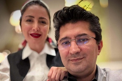 وقتی جراحی بینی سرنوشت شیلا خداداد را تغییر داد!